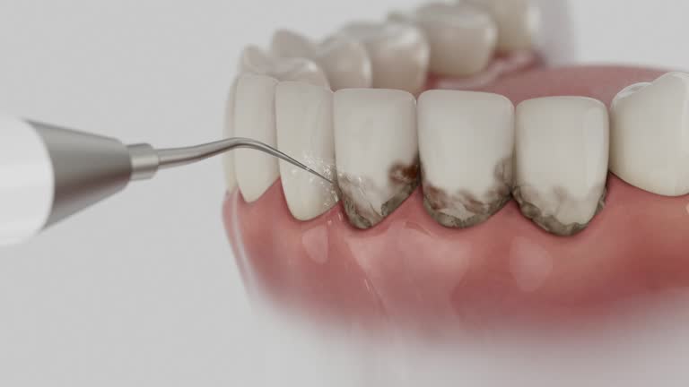 Reliable Root Canal Treatment contractor in Knox County County, OH by Dentist Open Now
